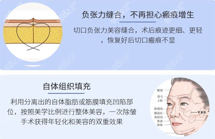 电波皮和手术拉皮那个更好_电波拉皮术需要多少钱_电波拉皮术后注意事项