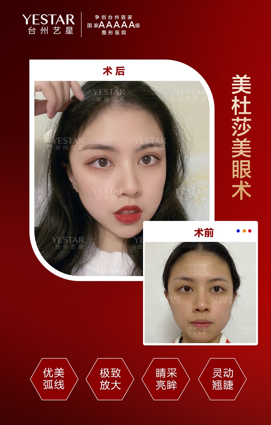 有谁做过美杜莎美眼术 美杜莎美眼术靠谱吗？听听普通女孩的真实体验与纠结